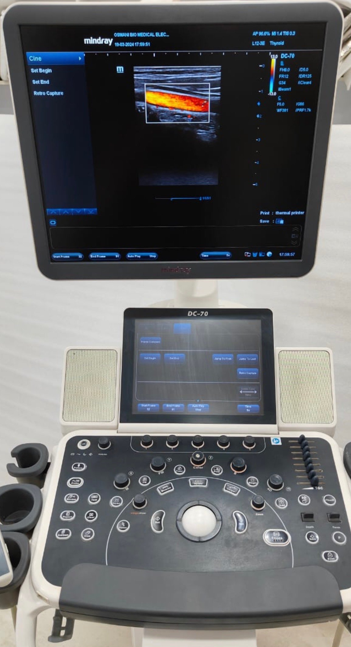 Excellent Mindray DC-70X (2019) image 4