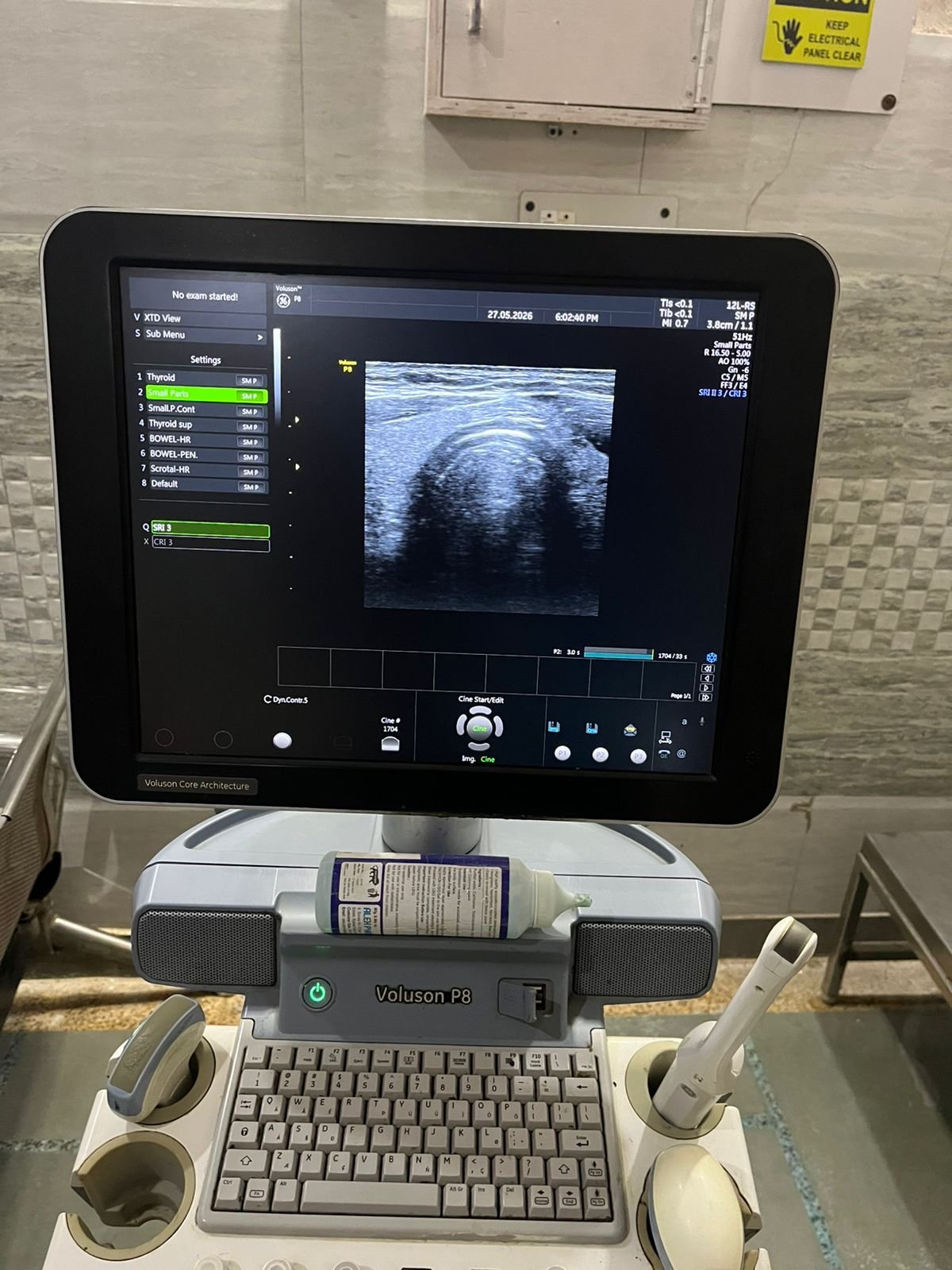 Good Condition GE Healthcare Voluson P8 (2017) image 2