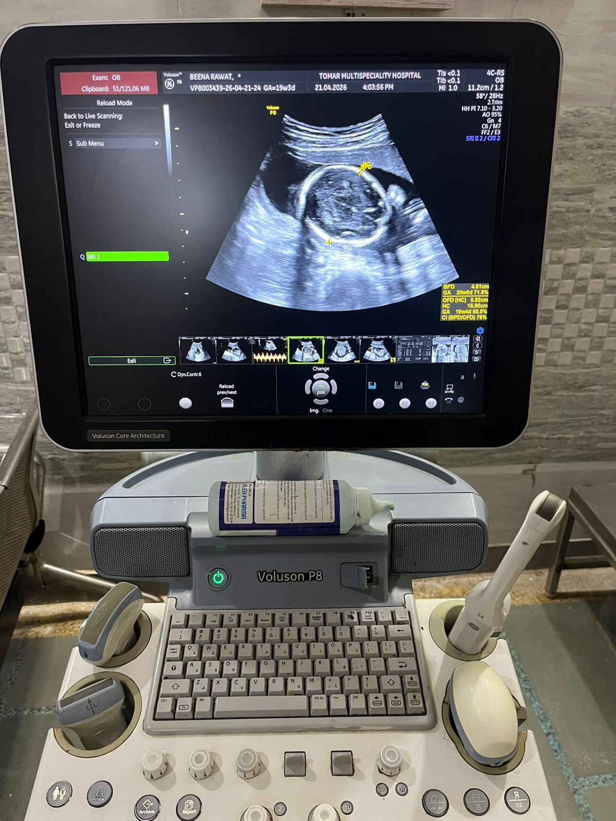 Good Condition GE Healthcare Voluson P8 (2017) image 6
