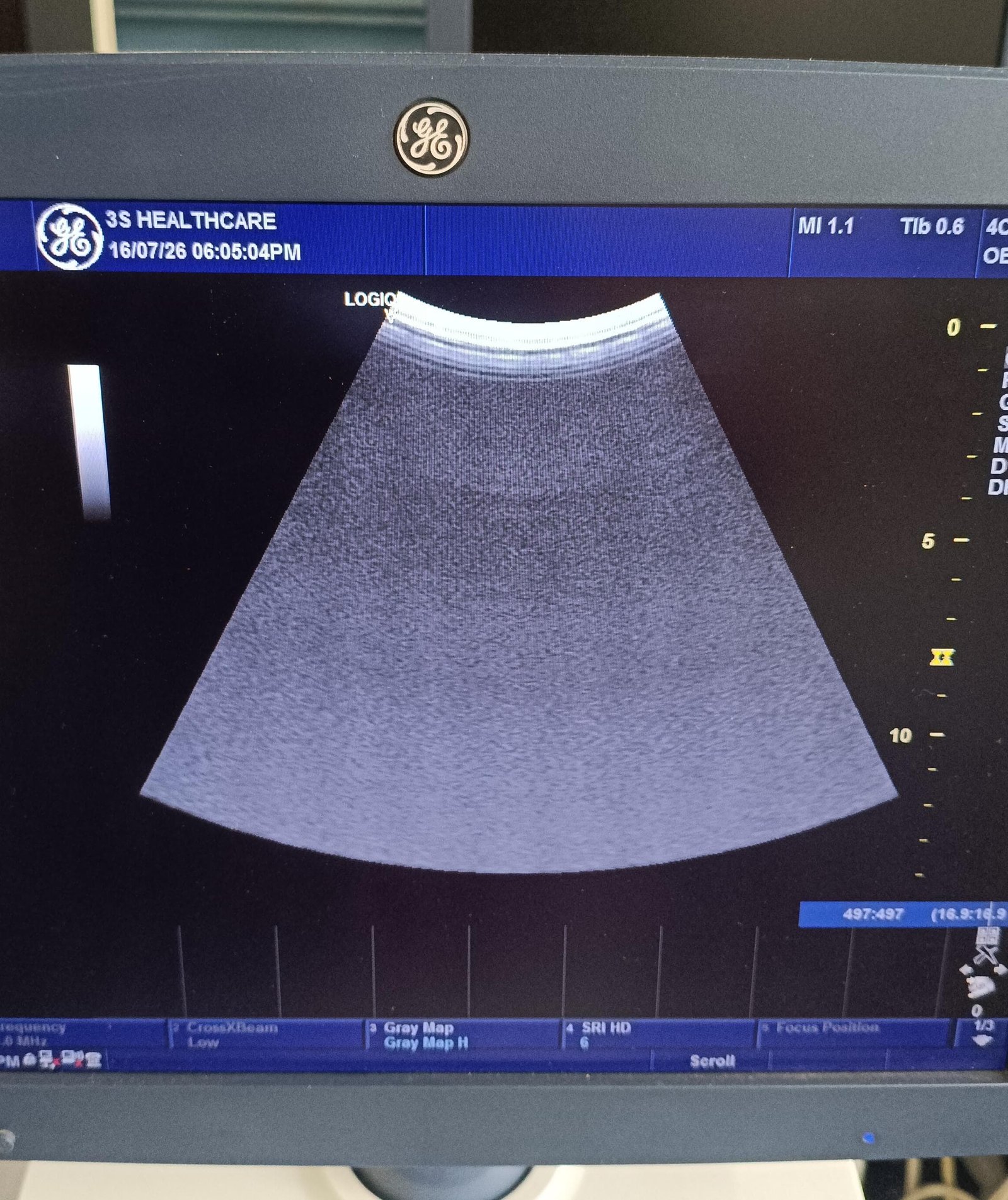 Excellent GE Healthcare Logiq V5 (2015) image 4
