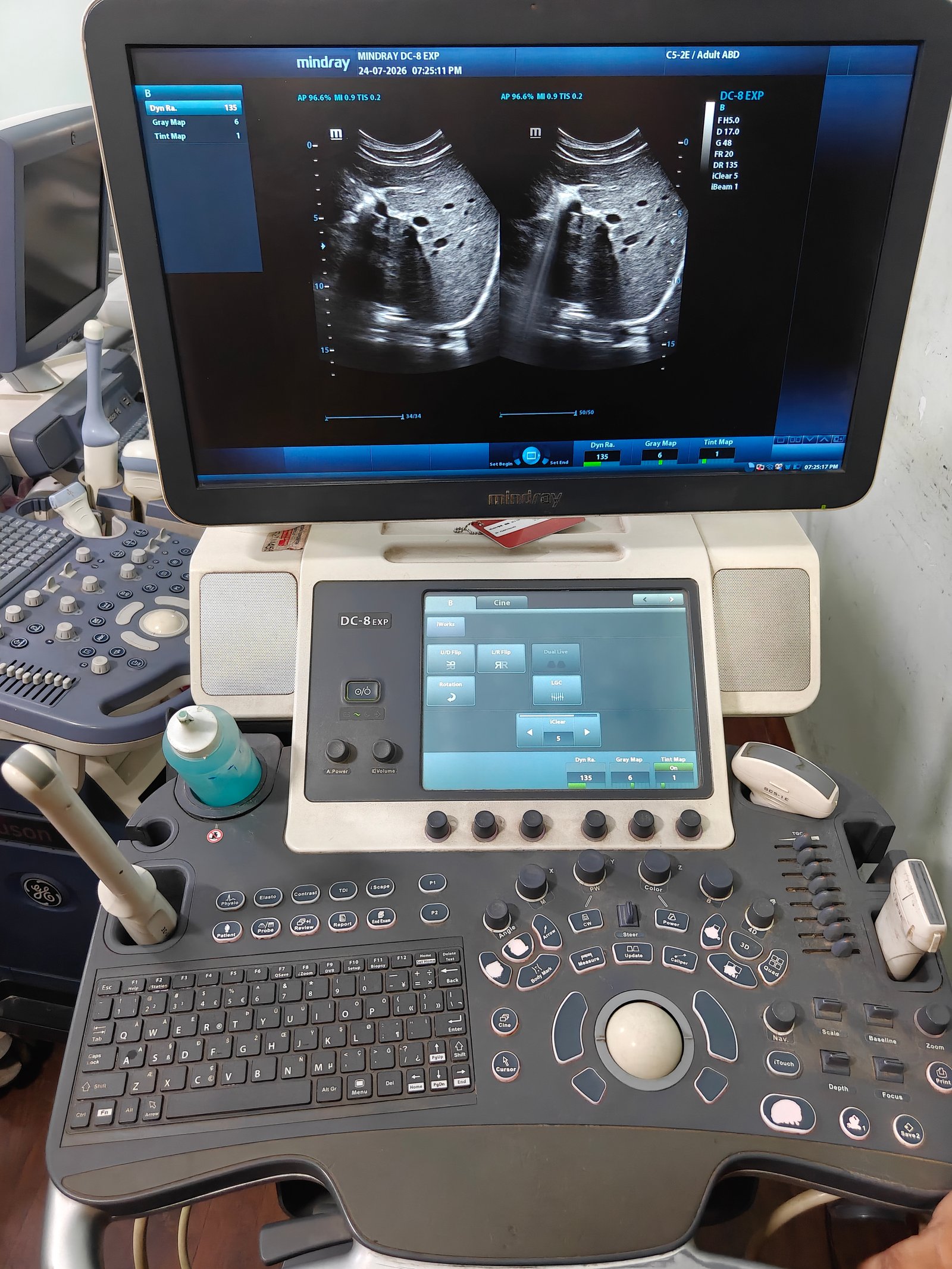 Good Condition Mindray DC8 (2018)