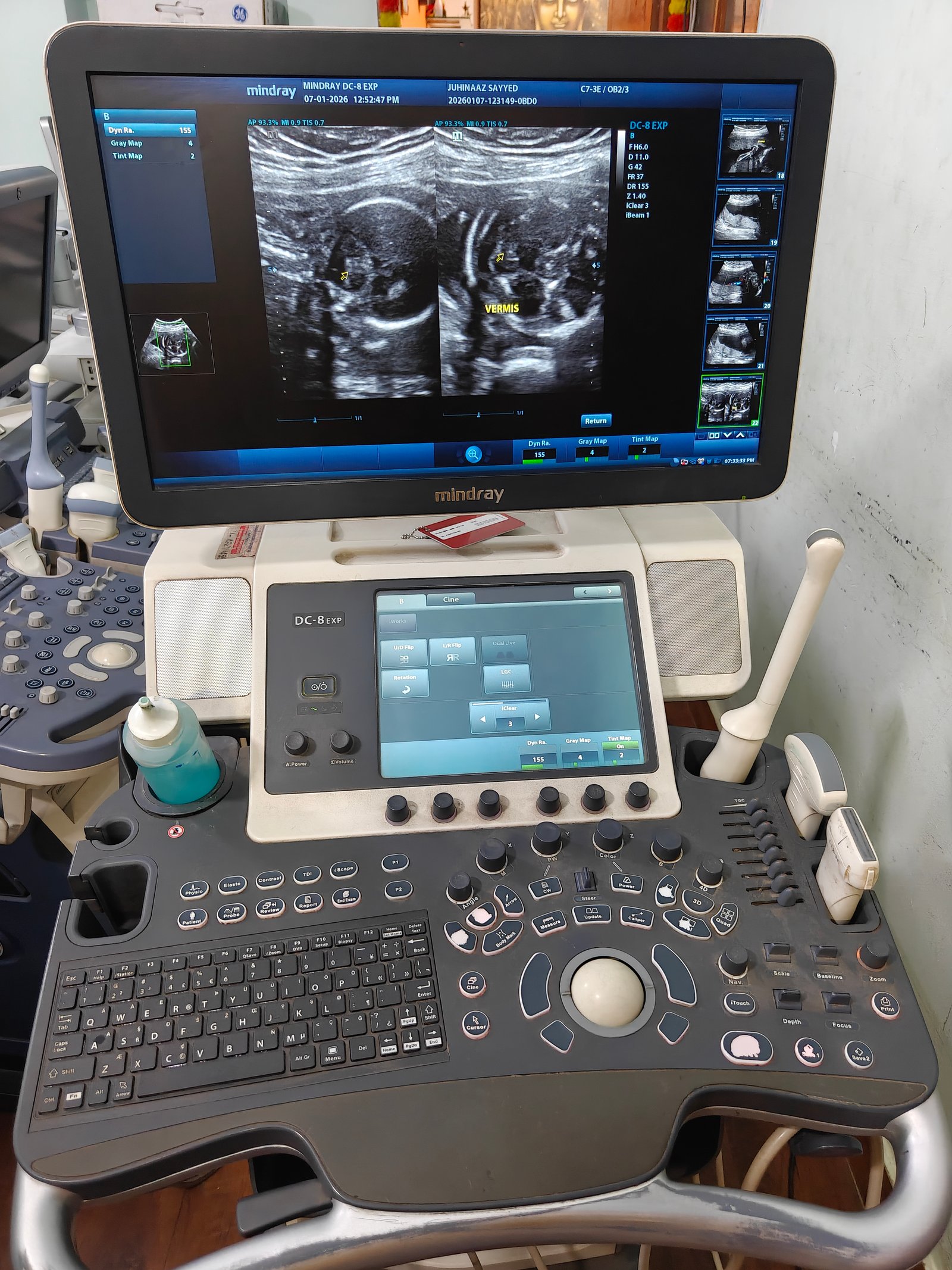 Good Condition Mindray DC8 (2018) image 3