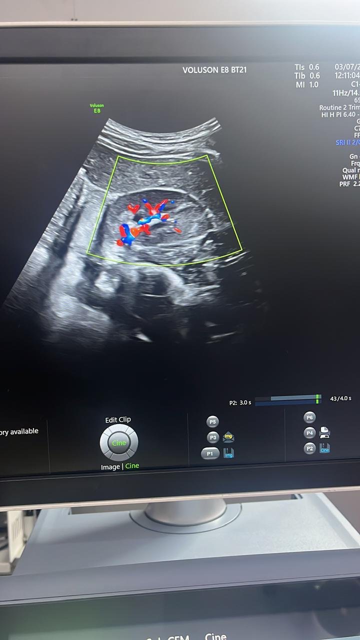 Excellent GE Healthcare Voluson E8 (2024) image 2