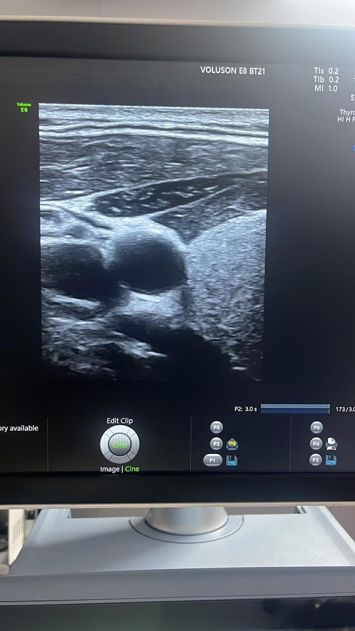 Excellent GE Healthcare Voluson E8 (2024) image 3