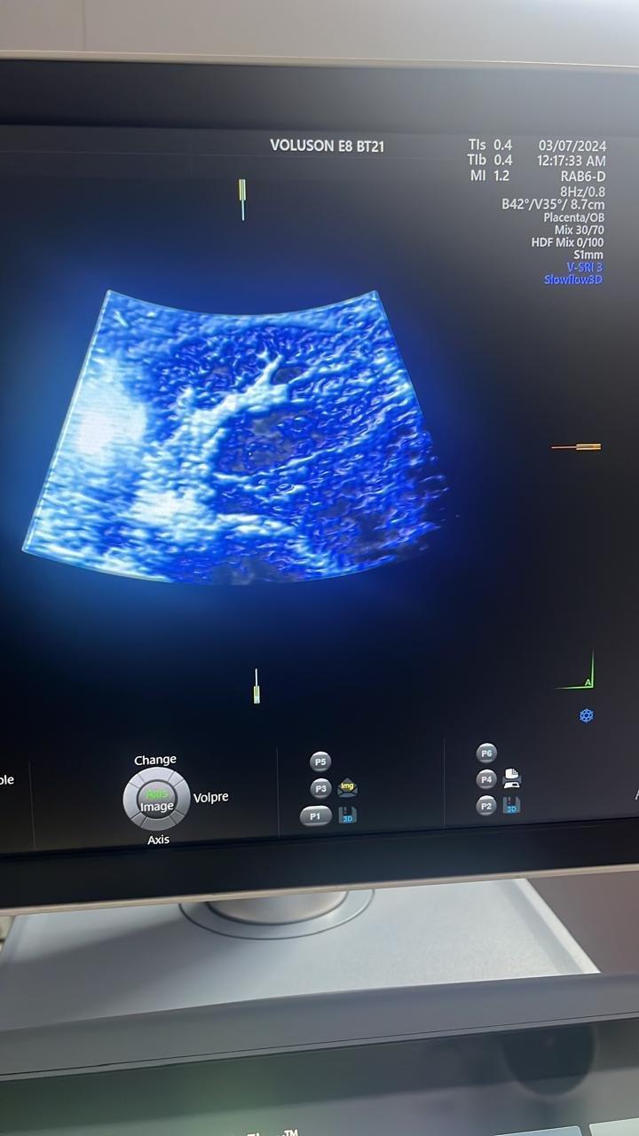 Excellent GE Healthcare Voluson E8 (2024) image 4