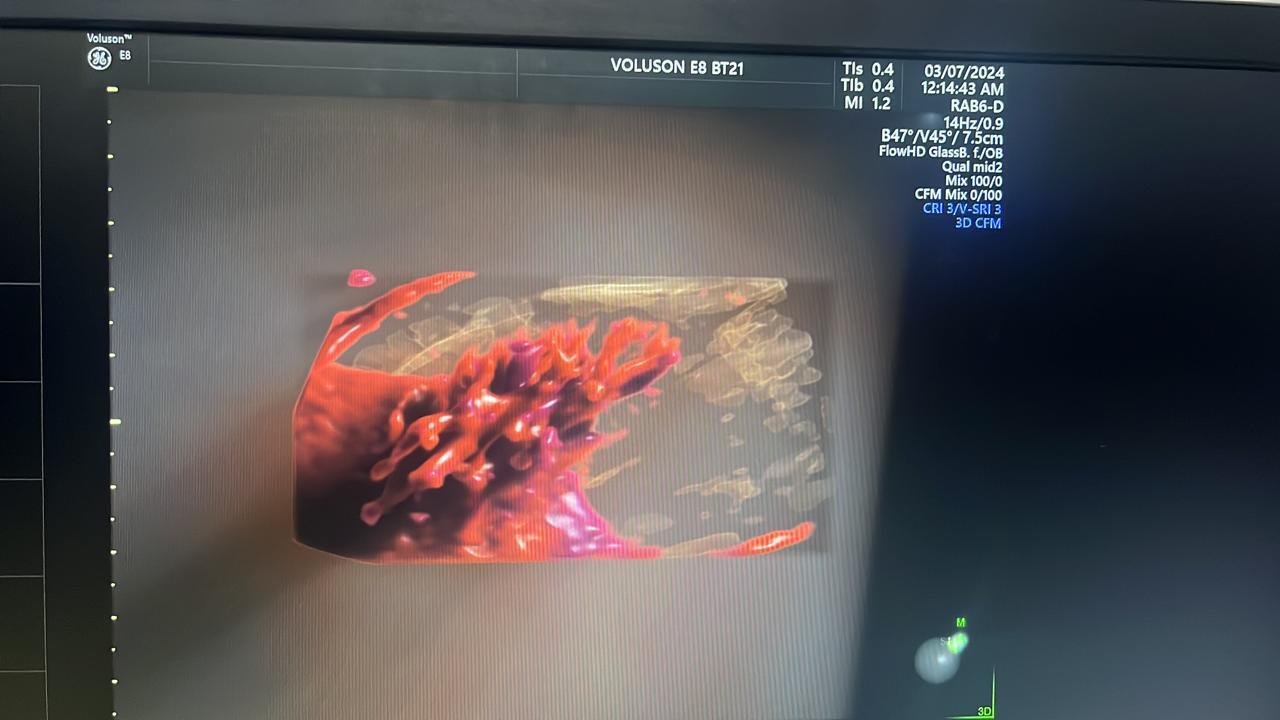 Excellent GE Healthcare Voluson E8 (2024) image 5