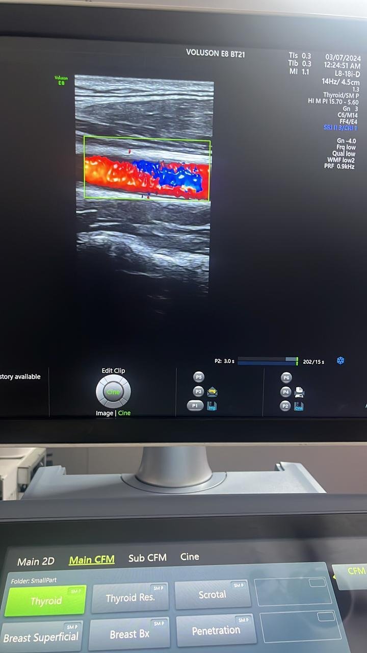 Excellent GE Healthcare Voluson E8 (2024) image 6