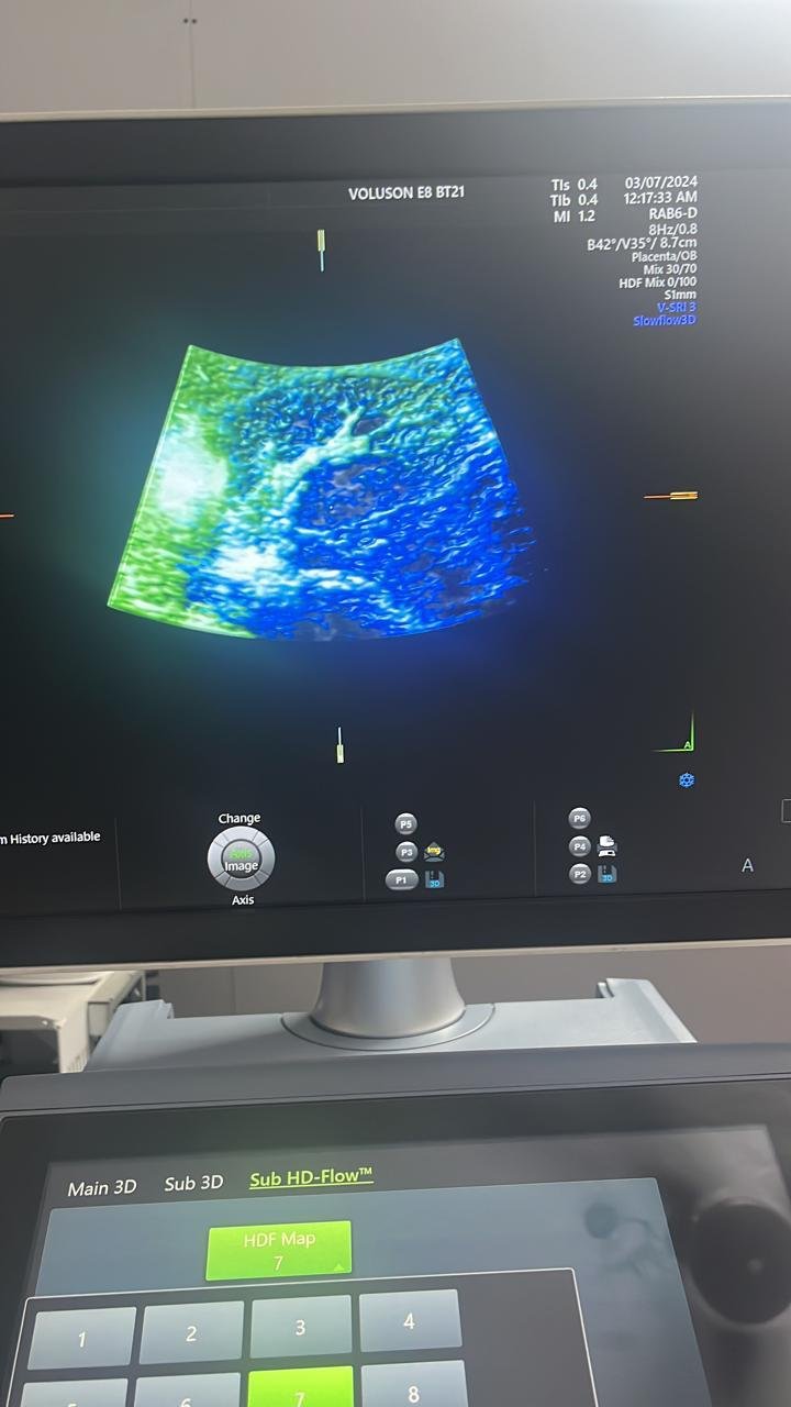 Excellent GE Healthcare Voluson E8 (2024) image 7