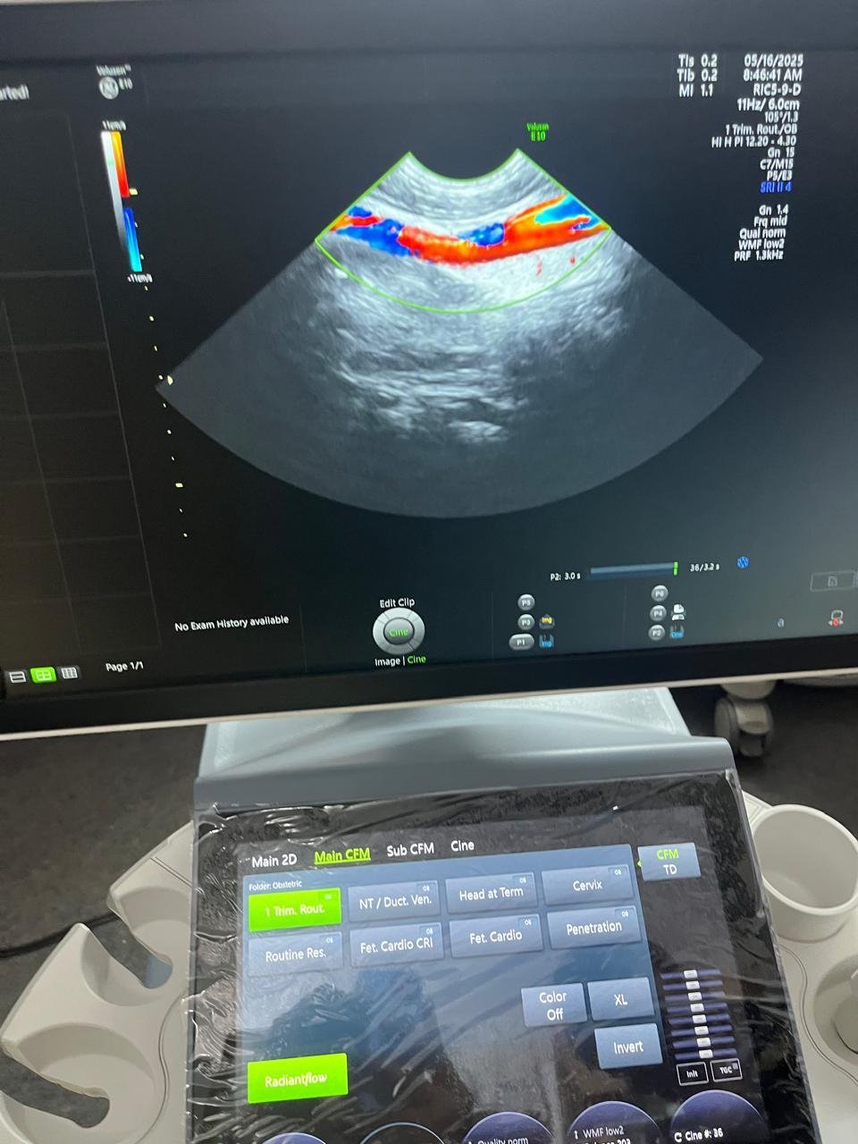 Excellent GE Healthcare Voluson E10 (2024) image 10