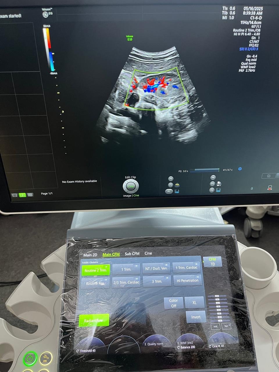 Excellent GE Healthcare Voluson E10 (2024) image 2