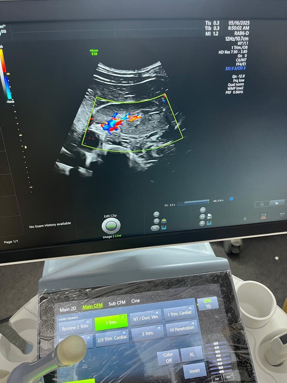 Excellent GE Healthcare Voluson E10 (2024) image 4