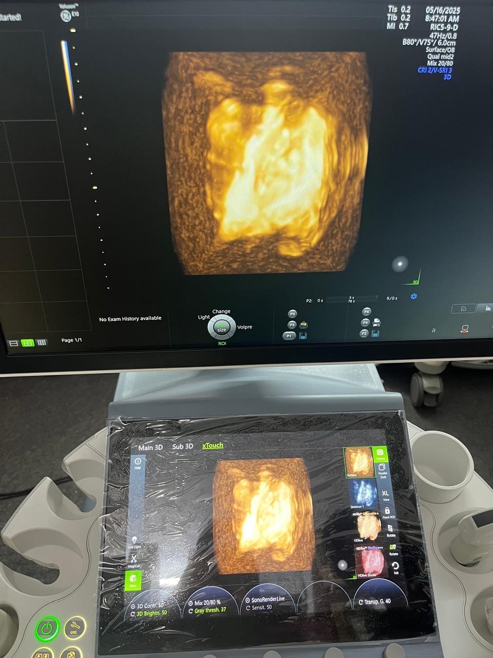 Excellent GE Healthcare Voluson E10 (2024) image 5