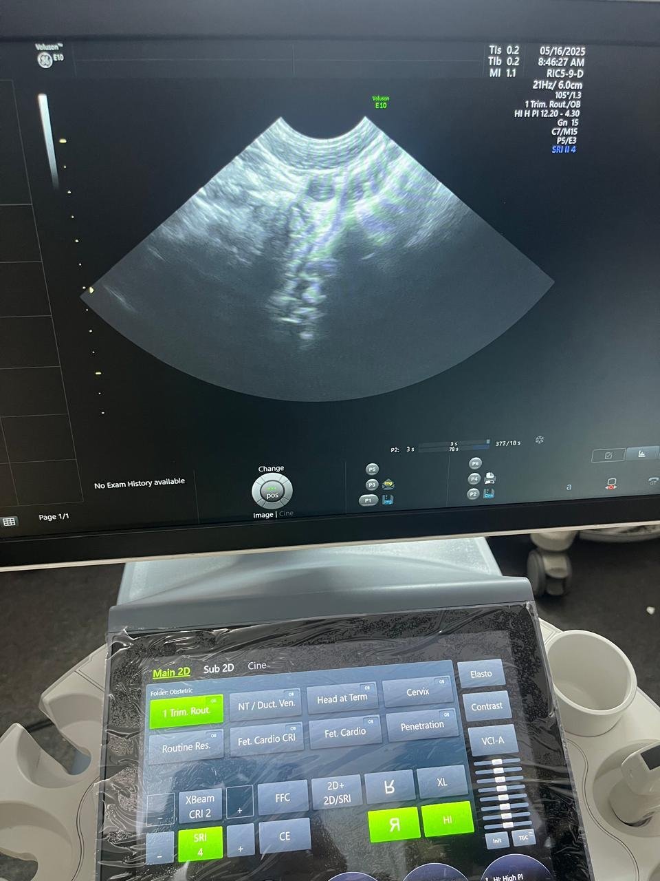 Excellent GE Healthcare Voluson E10 (2024) image 7