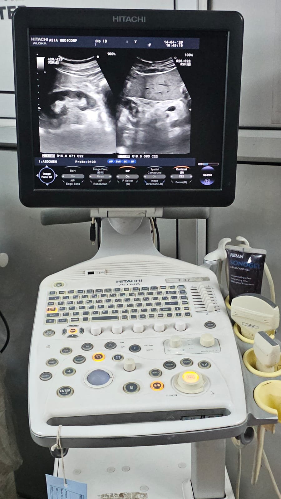 Excellent HITACHI ALOKA PROSOUND F37 (2019)